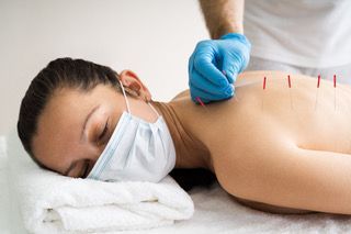 Acupuntura